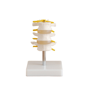 Normal lumbar vertebrae combination (three sections)